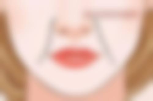 双眼皮术后注意啥?其他事项别忽略