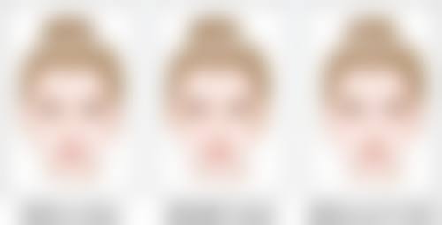 哪些疤痕适合激光治疗?激光祛疤的疗程、护理与成效