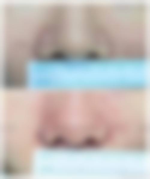 七、安康青美医疗美容整形外科诊所真实的顾客评价如下: