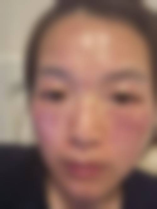 六、荆州市第一人民医院(整形美容科)怎么预约: