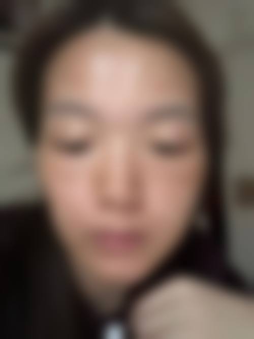 四、西安贝芙丽医疗美容雁塔整形实例