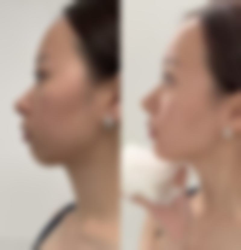 五、西安贝芙丽医疗美容雁塔整形怎么预约: