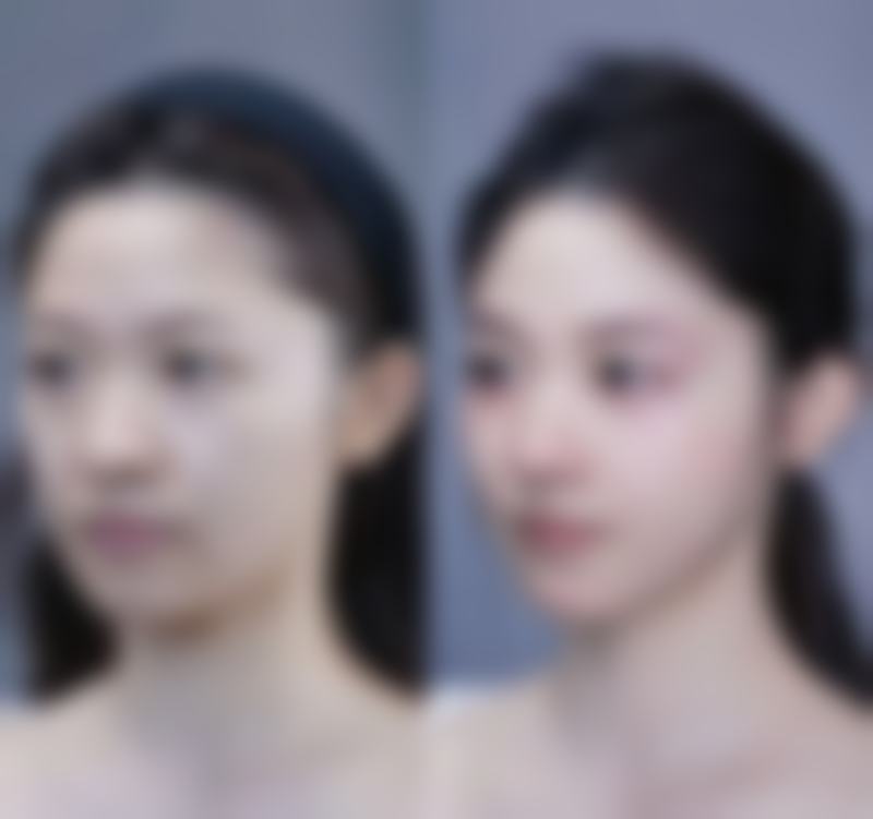 儿童眼袋发青调养之饮食调理策略