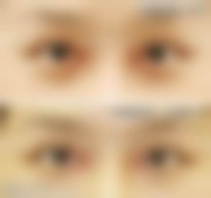 北京客来美舍医疗美容诊所张冰洁履历成就揭秘，23年专注眼整形修复近万例手术