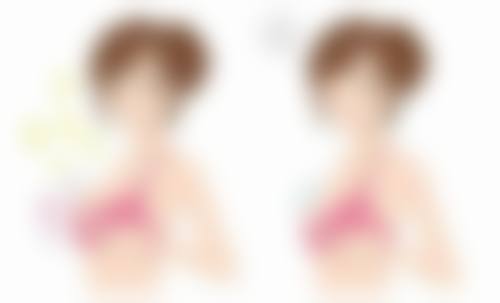 埋线双眼皮宽窄不一:常见原因大剖析