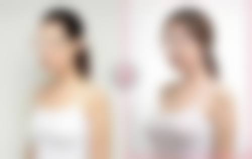 八、赣州芳华(明珠丽格)医疗美容医院真实的顾客评价如下: