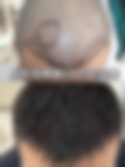 陶彦君医生实例