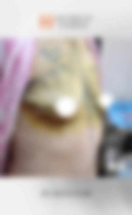 八、长沙芙蓉区鹏爱整形医疗美容门诊部真实的顾客评价如下: