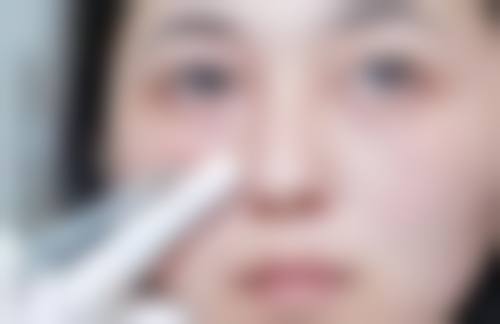 隆鼻全麻多久能醒?小型整容隆鼻手术的苏醒特点