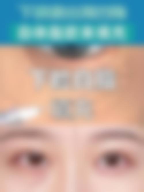 代其超医生实例