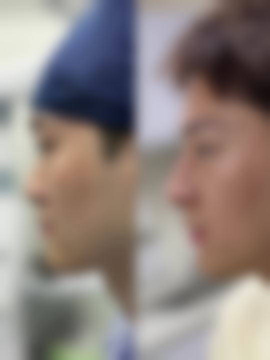 五、邹城李沐妍整形医院实例