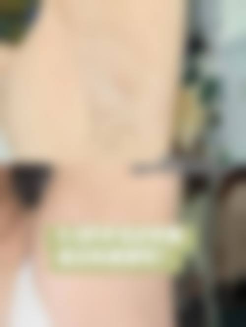 七、东莞天瑜整形医院价格表:(仅供参考)