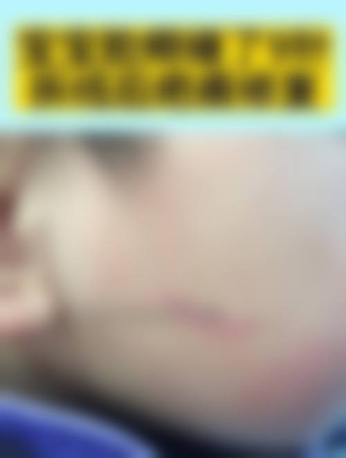 陈剑平医生实例