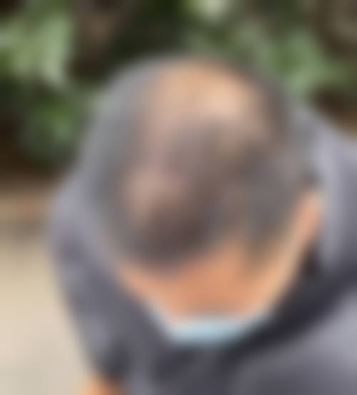 八、东莞天瑜整形医院真实的顾客评价如下: