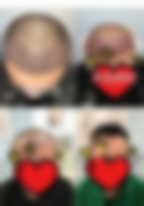 六、成都景华医疗美容门诊部怎么预约：