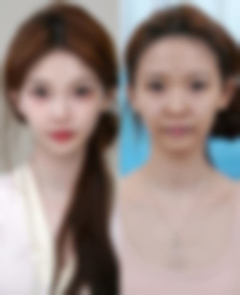 五、菏泽枫颜整形美容医院实例