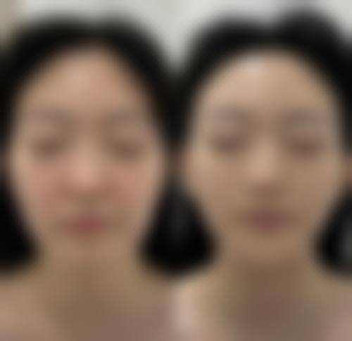 五、南阳丽妃医疗美容门诊部实例