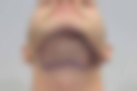 七、广东东莞壹阳植发真实的顾客评价如下：