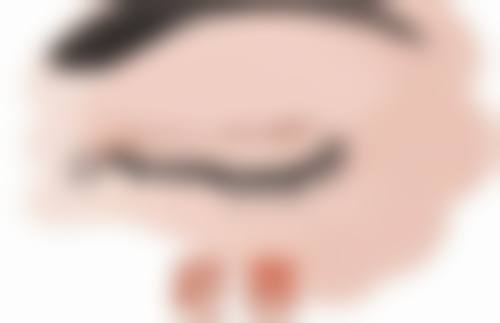 割完双眼皮长期备孕考量：术后半年更安心