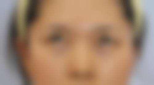 七、佛山顺德姬妍整形医院价格表：（仅供参考）