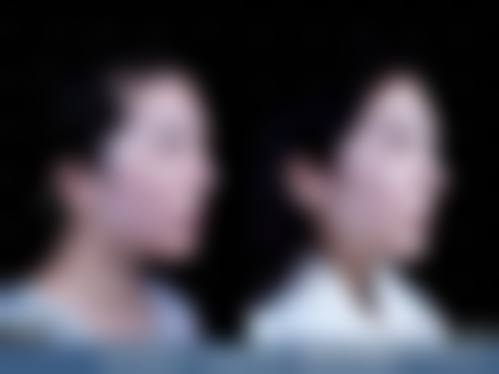 杨青云医生在哪家医院怎么预约?