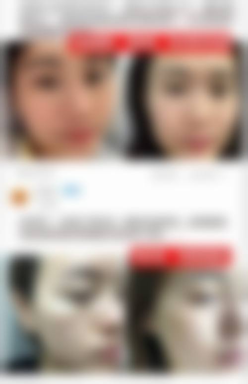 七、和歌山SkinCare诊所价格表:(仅供参考)