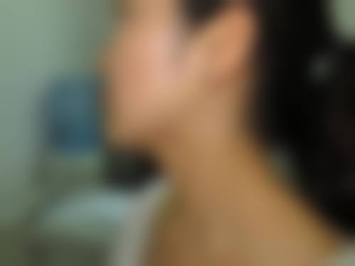 五、上海君倪医疗美容门诊部实例