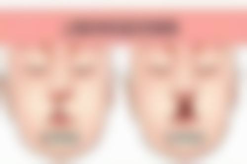 郑瑰琦医生实例