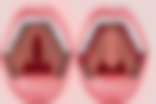 郑瑰琦医生在哪家医院怎么预约?