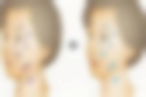 还在为过敏因素导致的血管型黑眼圈发愁？这些滴眼液能救急