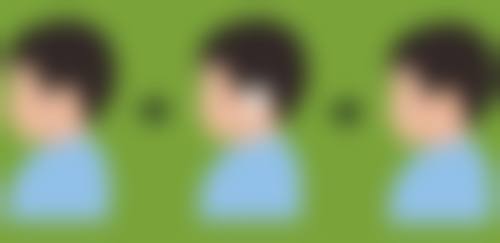 做眼袋手术：术前术后参考建议