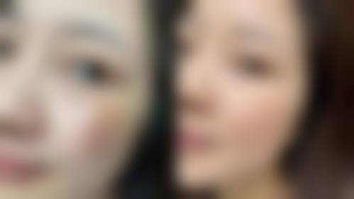 八、韩国JUAN珠颜皮肤科真实的顾客评价如下: