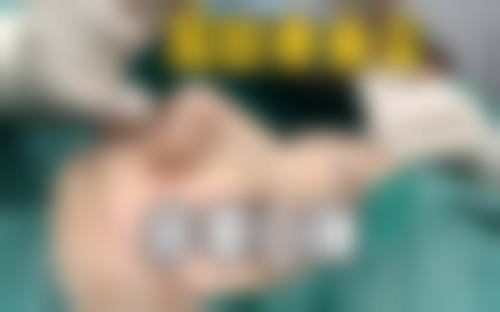 七、海南博鳌恒大国内外医院整形科真实的顾客评价如下: