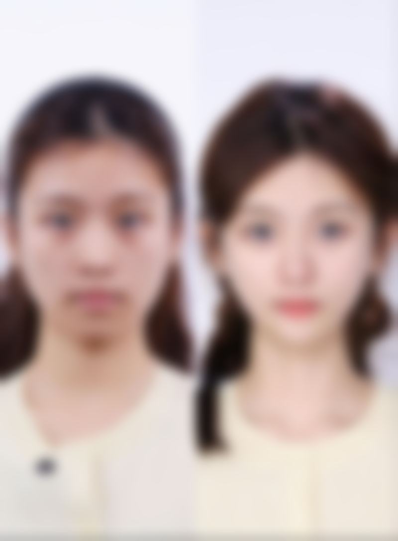 四、青岛万姿医疗美容诊所开展的主要项目和特色项目: