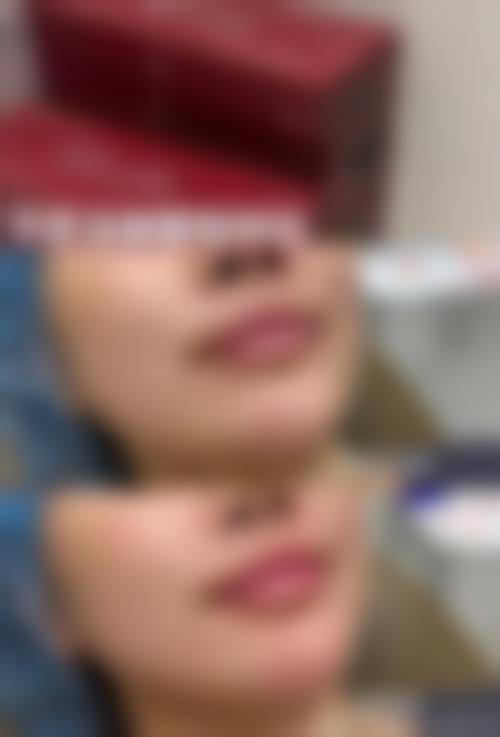 七、岳阳禾美荟整形价格表：（仅供参考）