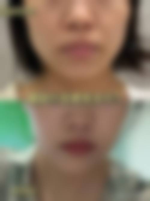 六、西安蔻华医疗美容诊所价格表：（仅供参考）