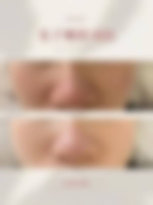 曾慧智医生实例