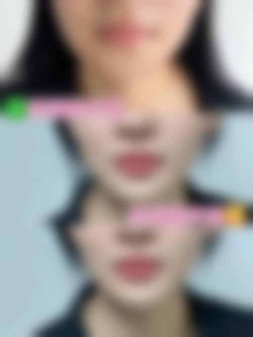 七、贵阳云岩雪雅医院整形美容科价格表：（仅供参考）