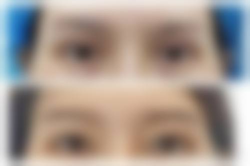 八、襄阳伊尔美丽整形美容门诊部真实的顾客评价如下: