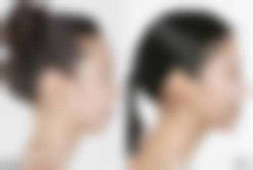 五、菏泽孙忠贵整形外科诊所实例