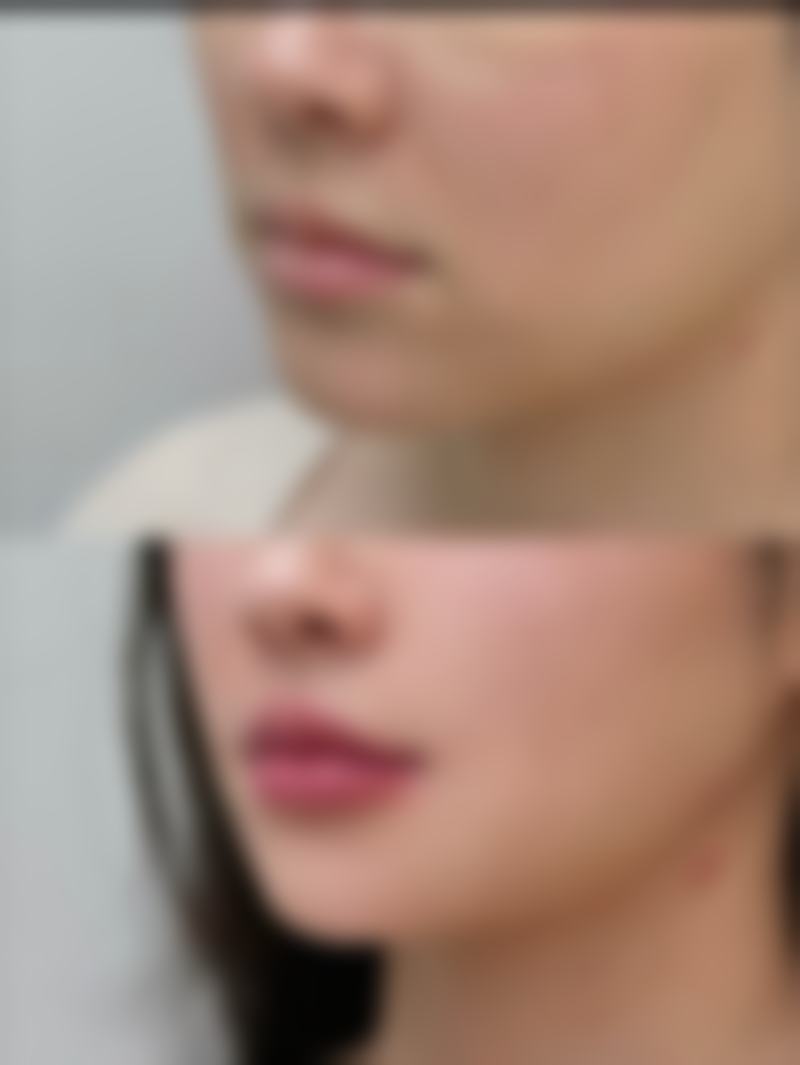总结：疤痕修复膏的利与弊