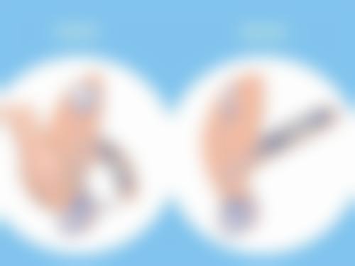 缝针疤痕能否消除?实际实例给你信心