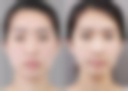 四、皖南医学校第二附属医院整形美容科实例