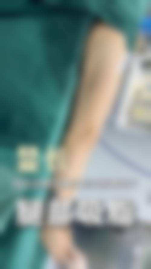 七、解放军第二炮兵总医院激光整形美容科真实的顾客评价如下: