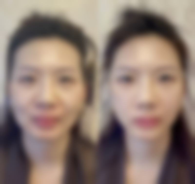 五、韩国艺成整形外科实例