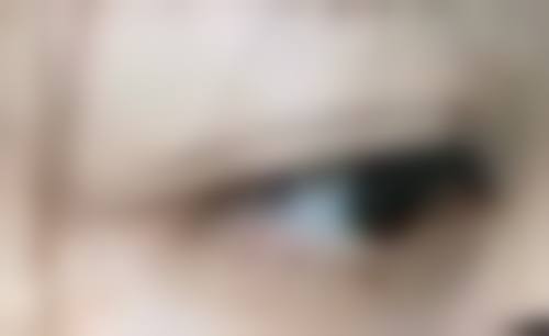 隆鼻选啥消炎针成效佳?不同隆鼻手术的用药参考