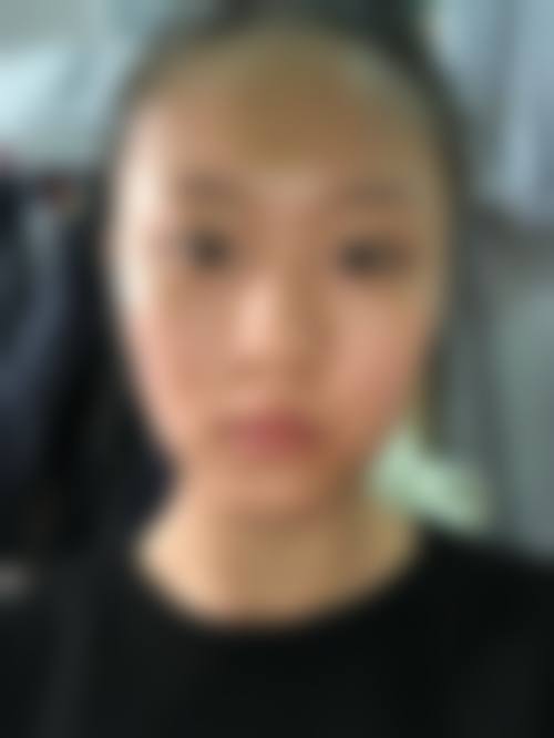 四、深圳诺可研整形医院开展的主要项目和特色项目：