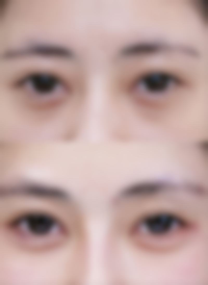 五、洪镇柱整形外科医院实例