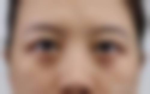 五、Cooki整形外科实例