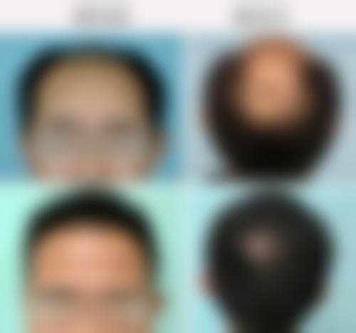 八、成都夏芙医疗美容诊所真实的顾客评价如下: